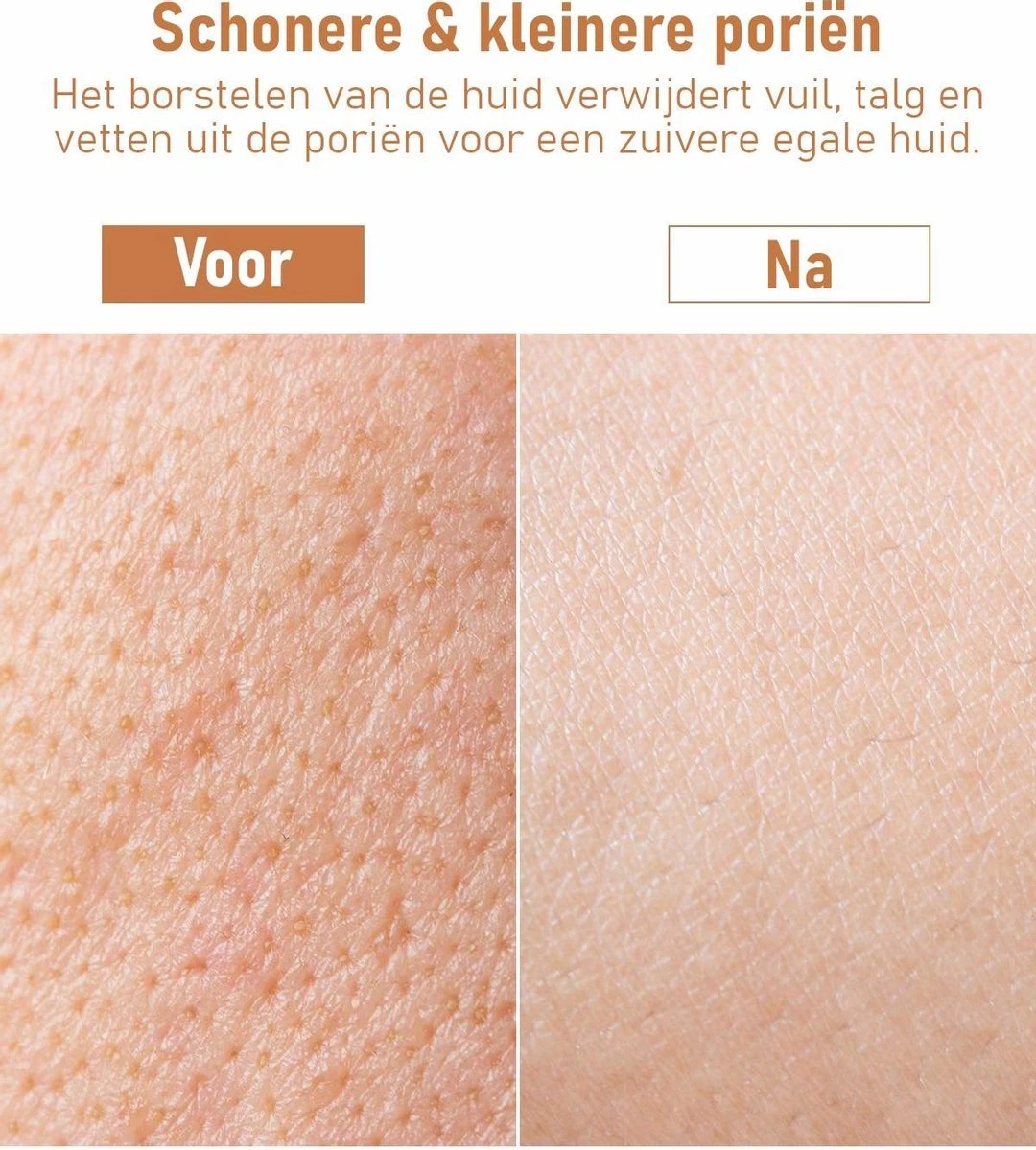 Fesio Lichaamsborstel Met Lange Steel - Dubbelzijdig - Dry Brushing Rugborstel/Badborstel/Doucheborstel/Huidborstel - 43 Cm - Afbeelding 7