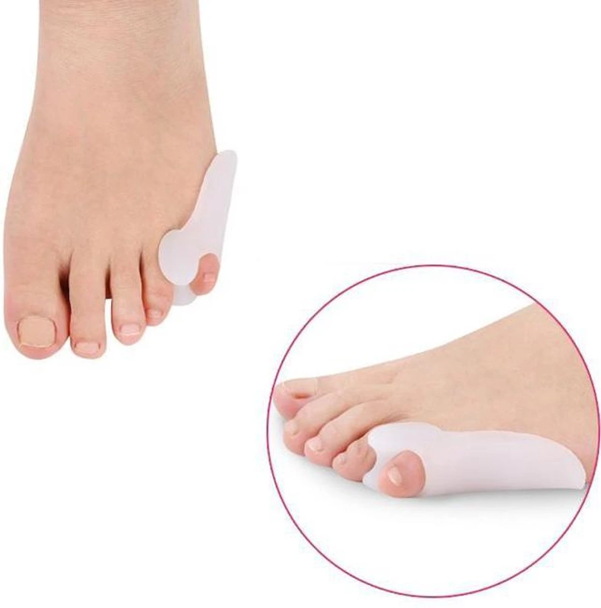 Merkloos Kleine Teenspreider - Hallux Valgus Siliconen Teencorrector - 2 Stuks - Wit