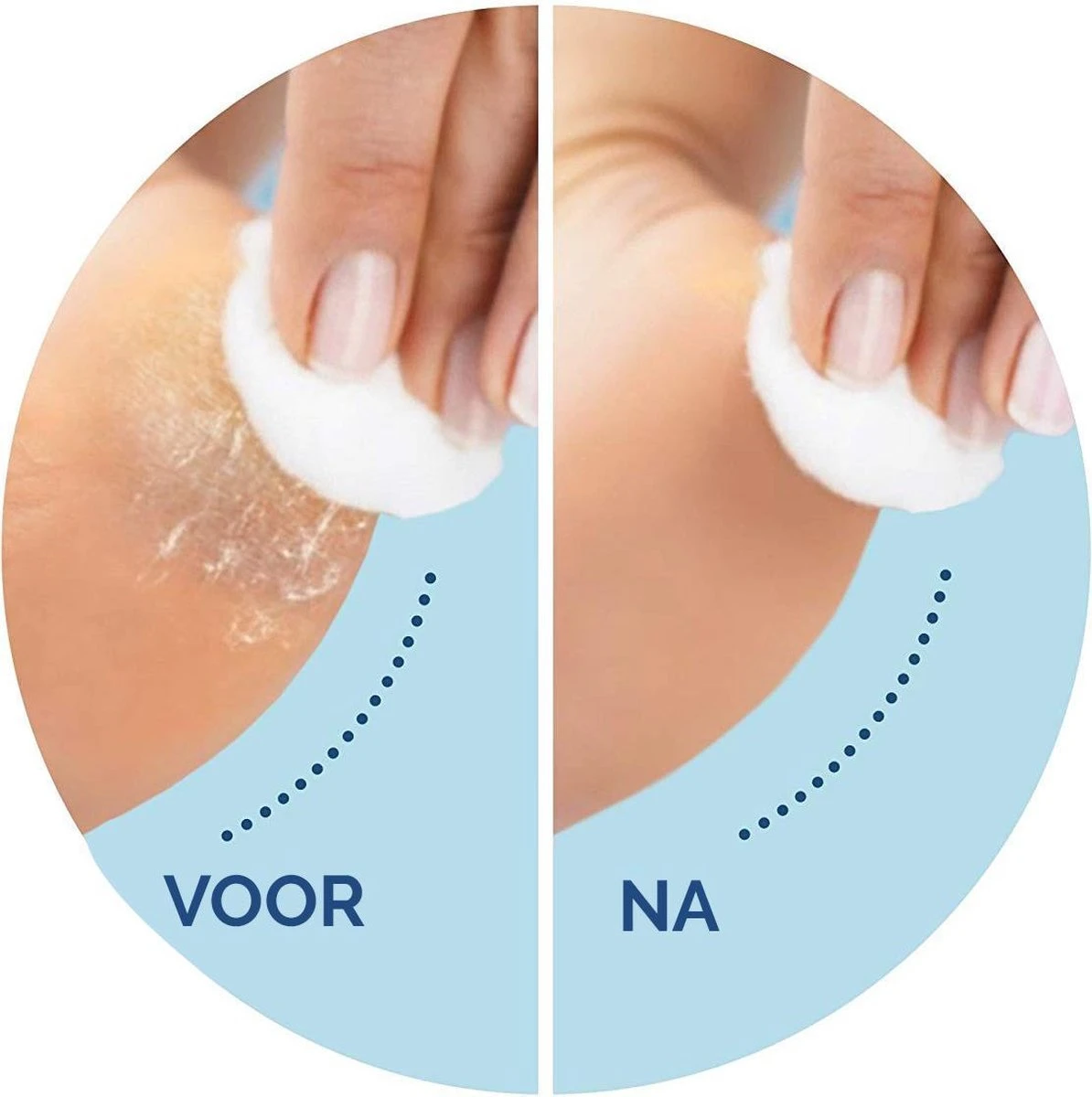 Scholl Velvet Smooth - Navulling Eeltverwijderaar - Regular - Voetvijl - 2 Stuks - Afbeelding 3
