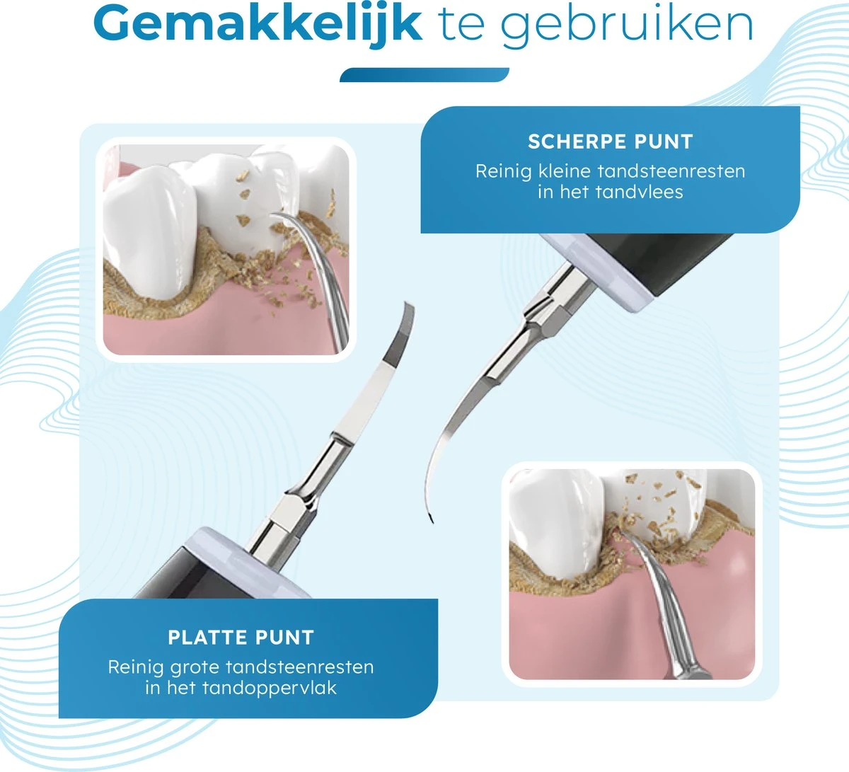 V-Goods Premium Sonische Tandsteen Verwijderaar - 5 Standen - Inclusief Tandarts Set - 3 Opzetstukken - Tandplak - Afbeelding 4
