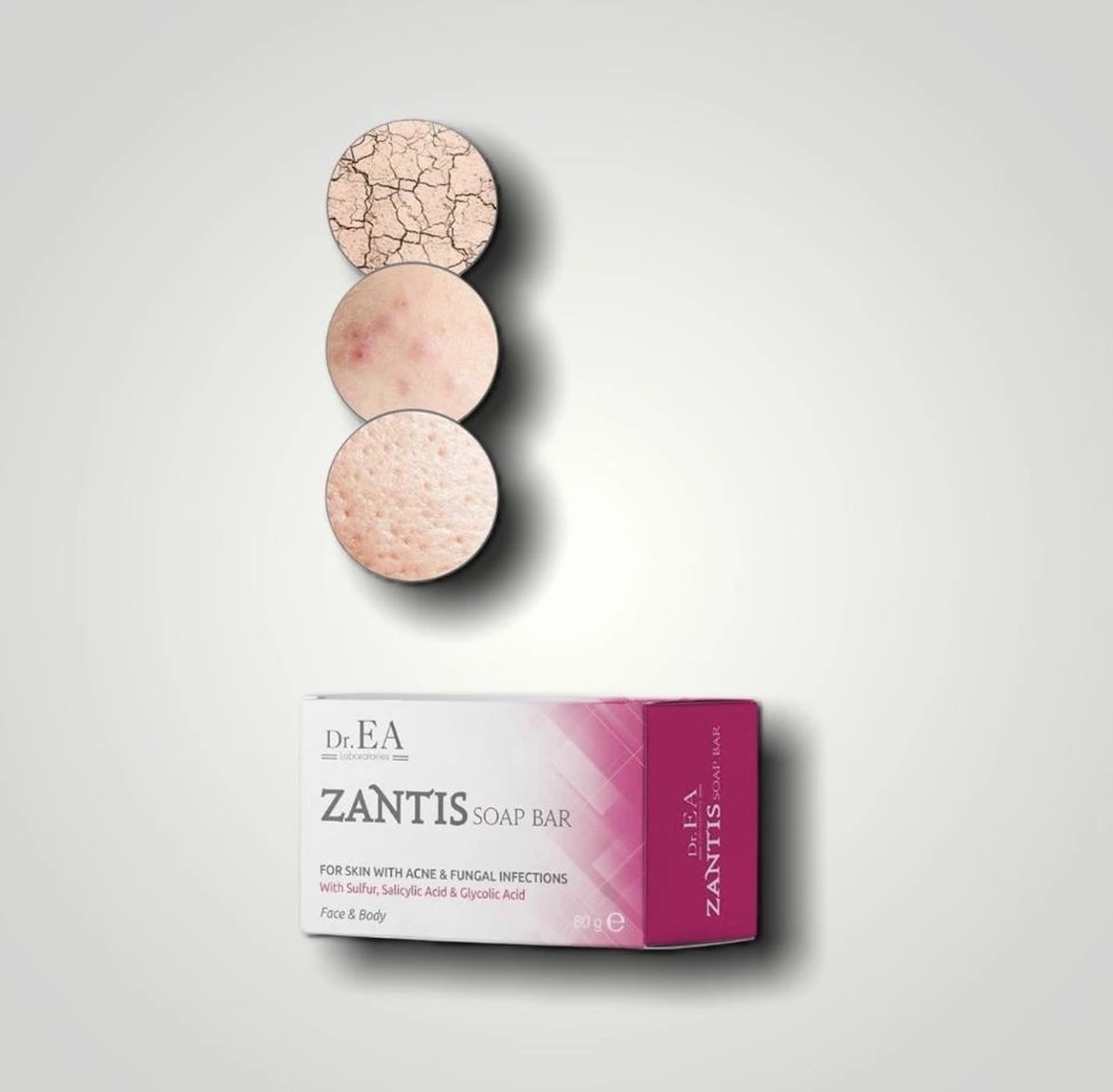 Dr EA Laboratories | Zantis | Medische Zeep Voor Gezicht En Lichaam | Voor Acne En Schimmelinfecties | Handzeep | Zwavel | Salicylzuur | Glycolzuur | Geel | Blok | 80 GR - Afbeelding 6