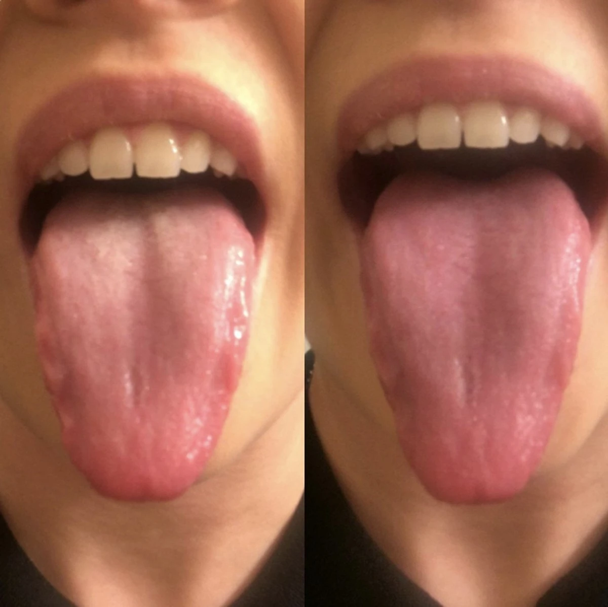 Orabrush Tongreiniger - Afbeelding 3