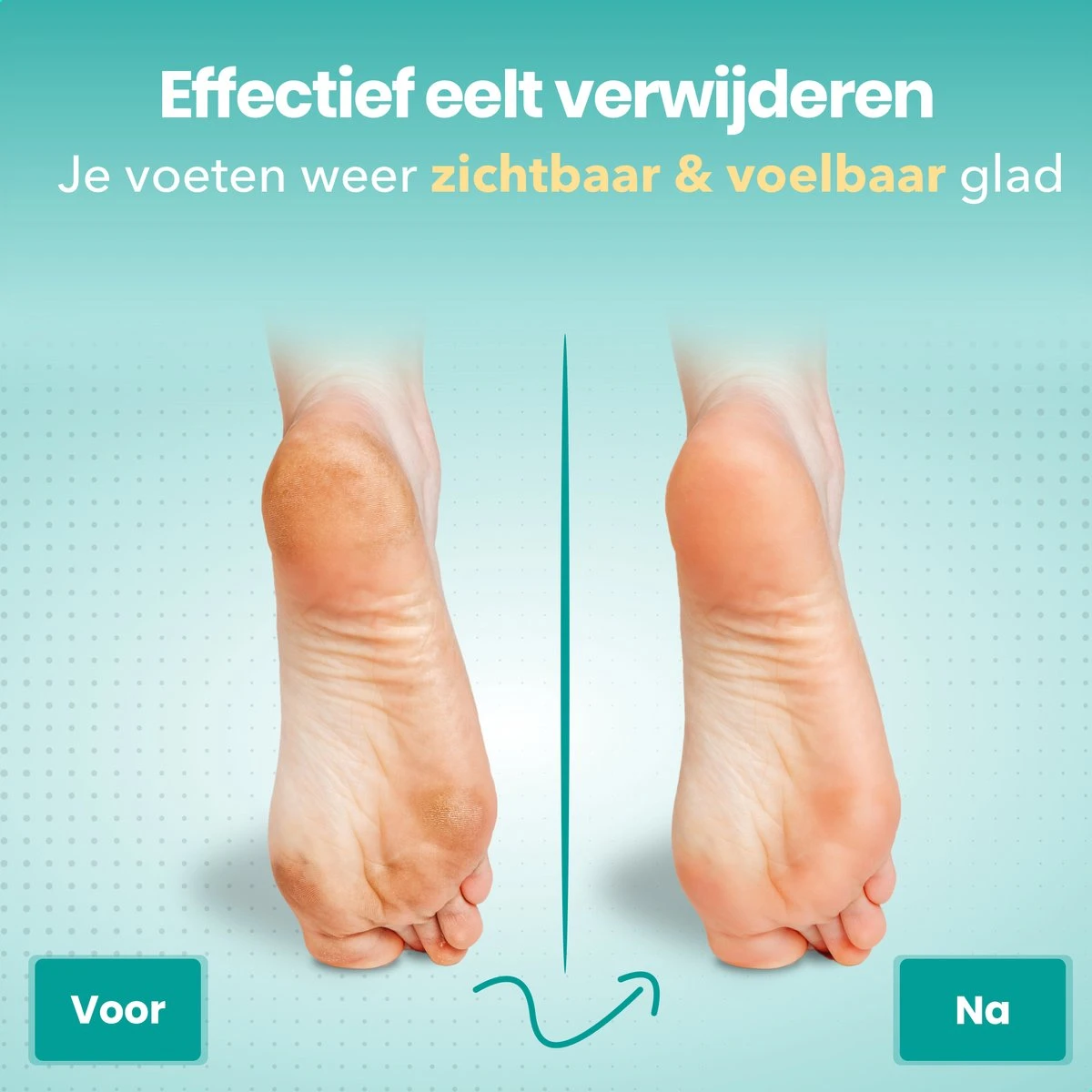 FreshDragon Elektrische Eelt Verwijderaar - Voetvijl - Inclusief 3 Rollers - Oplaadbaar - Afbeelding 6