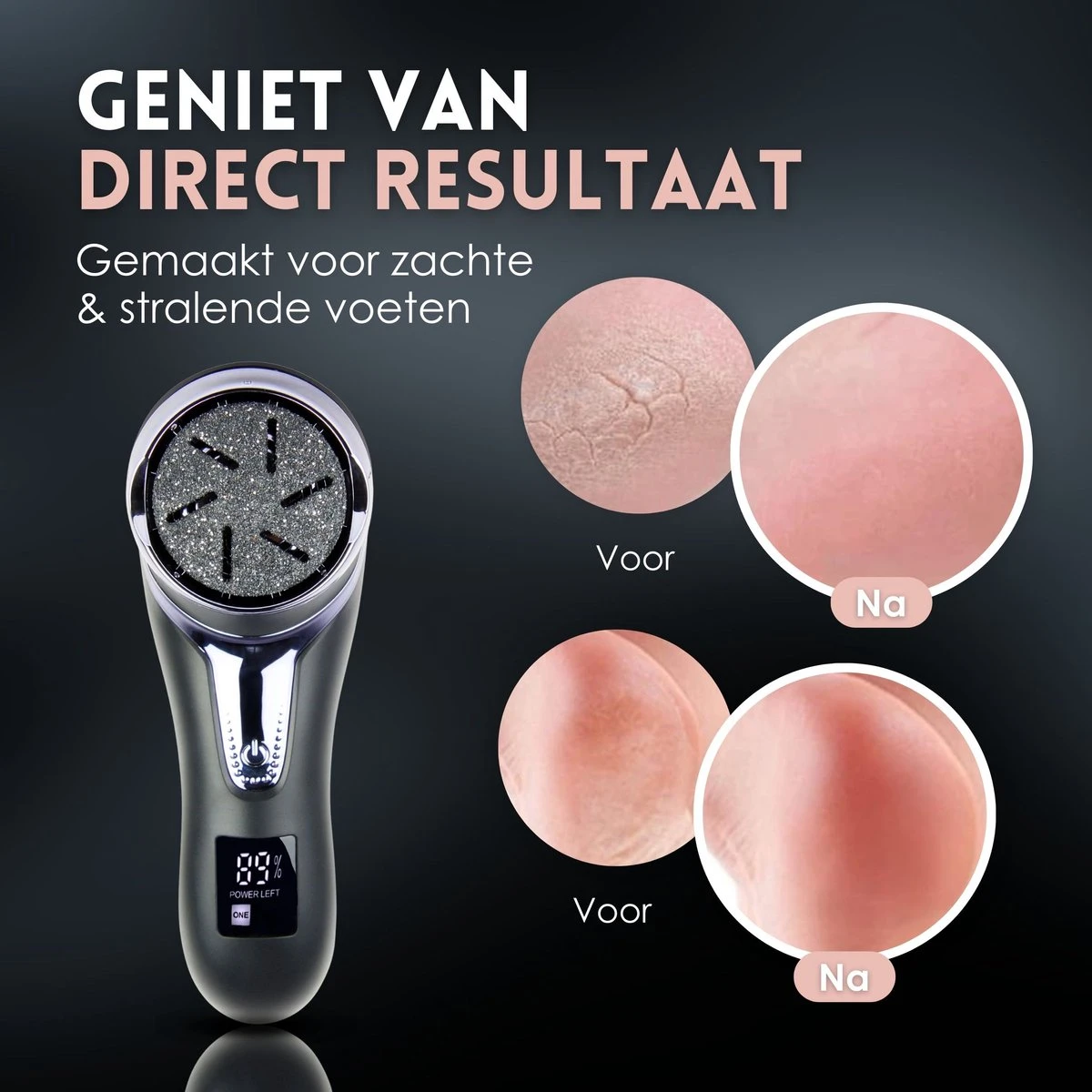 Beeperfect® Elektrische Eeltverwijderaar Met Stofzuigsysteem - Voetvijl - Eeltvijl - IPX7 Waterdicht - Gratis Pedicure Set - Zwart - Afbeelding 3