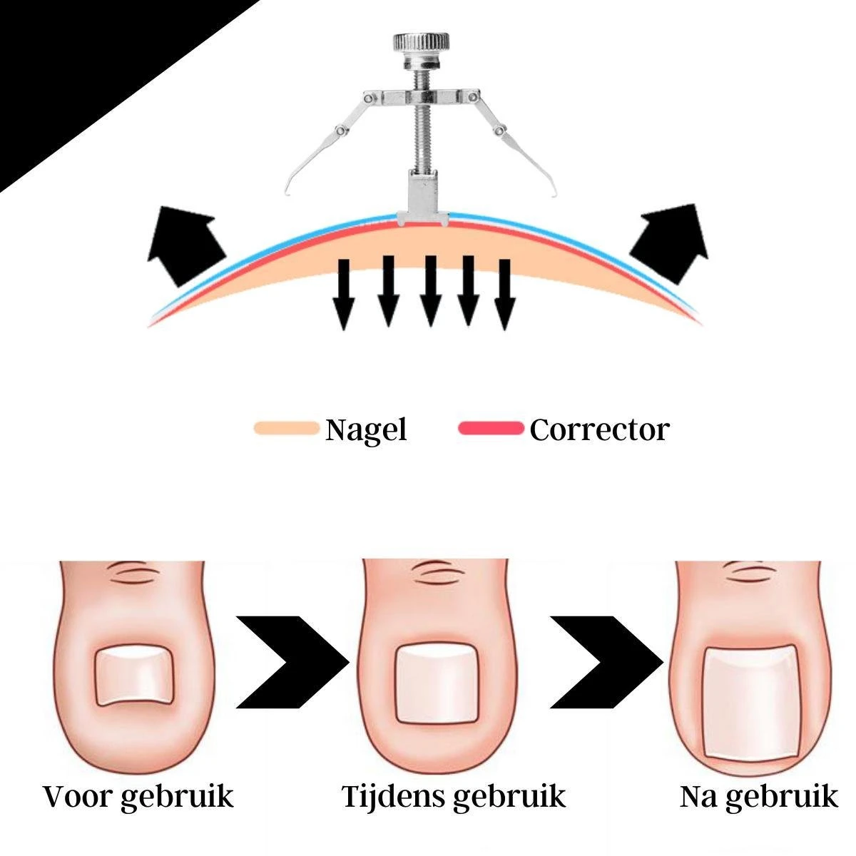 7-delige Pedicure En Manicure Set - Nagelknipper - Pedicureset - Nagelvijl - Nageltang - Kalknagel - Teennagelknipper - Afbeelding 5