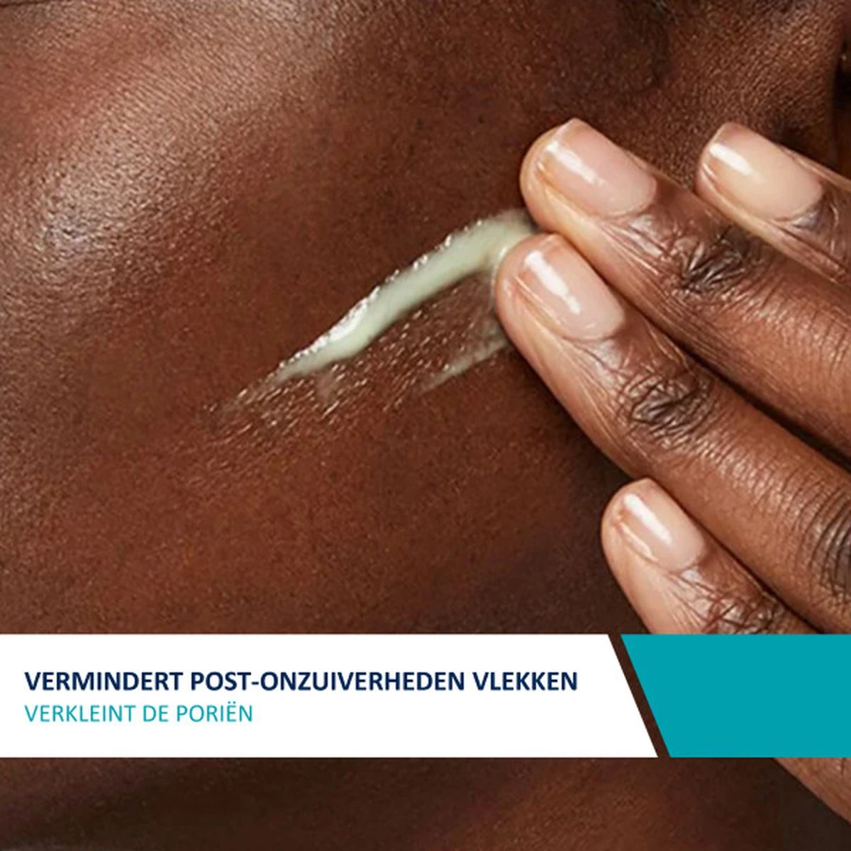 CeraVe Resurfacing Retinol Serum - 30ml - Voor Onzuivere Huid Met Neiging Tot Acne - Afbeelding 7