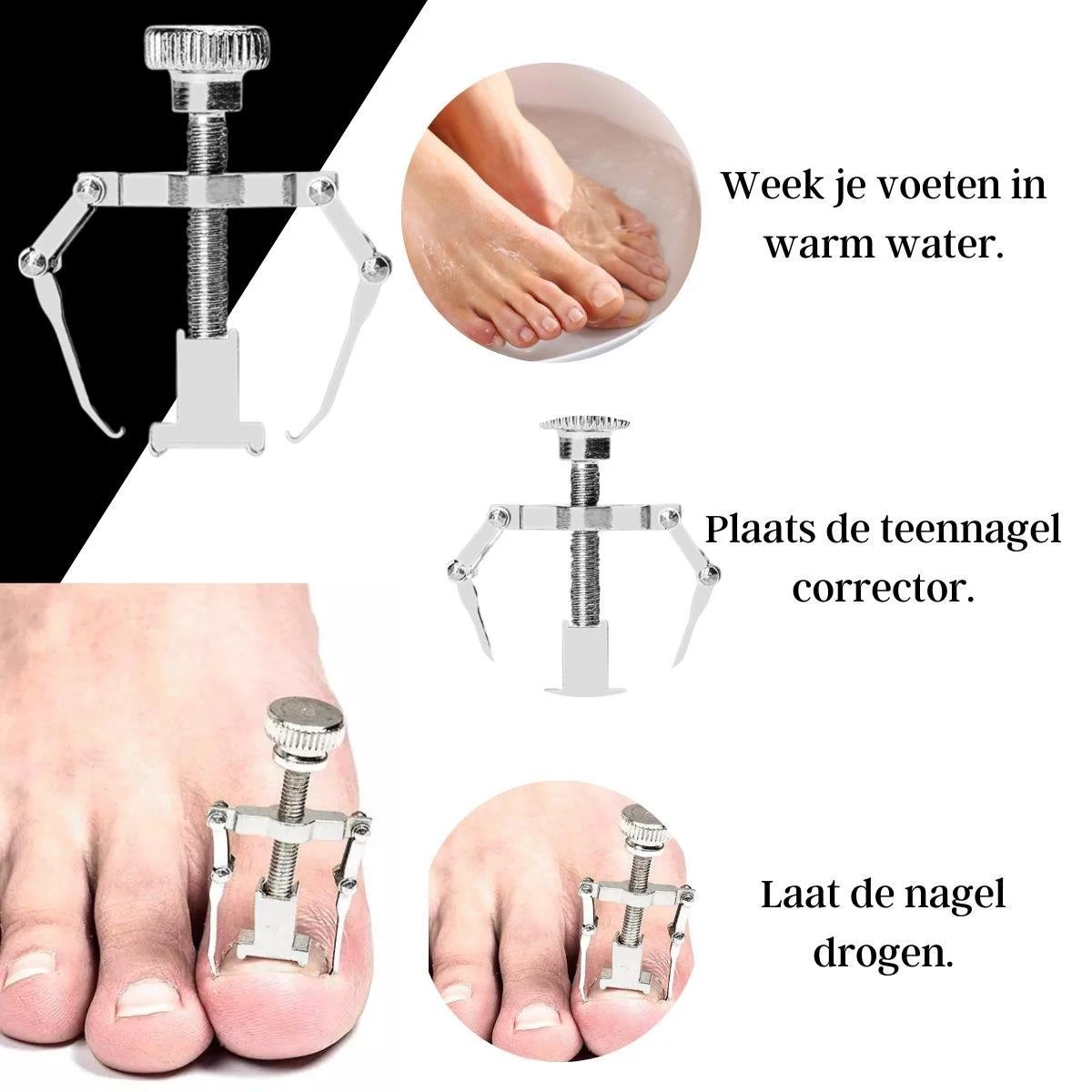 7-delige Pedicure En Manicure Set - Nagelknipper - Pedicureset - Nagelvijl - Nageltang - Kalknagel - Teennagelknipper - Afbeelding 8