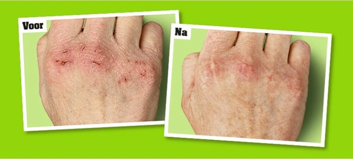 O'Keeffe's - Working Hands Creme - 96 Gram - Afbeelding 9