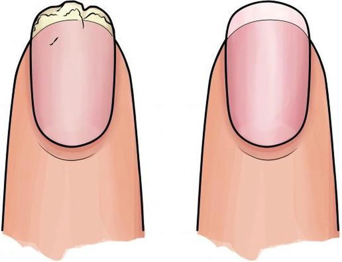 Herome 3 In 1 Manicure Nagelverzorging Set Blauw – Nagelset Voor Beschadigde Nagels - Nagelverharder, Nagellakremover En Nagelriemcreme - Set Van 3 - Afbeelding 3